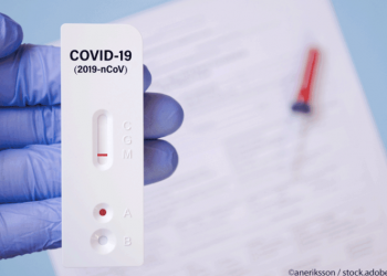 Se întâmplă la alții | De azi, în Austria se pot face teste antigen Covid-19 GRATUITE  la medicii de familie. Rezultatul, în 15 minute