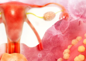 Dreptul la viață. Statul, obligat în instanță să le plătească un medicament costisitor. Femeile suferă de cancer