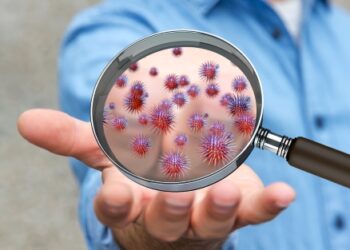 Daune record plătite unui pacient care a luat stafilococ auriu în spital. S-a internat cu un accident ușor. Dr. Flavia Groșan: Nu, nu cred în nosocomiale!