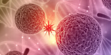 Rezultate „fără precedent” și „nemaivăzute”: un medicament oferă o remisiune completă a cancerului