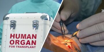 Medici trimişi în judecată pentru trafic de organe / Şi-au făcut afacere din importul ilegal a sute de cornee