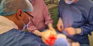 Tumoră gigant extrasă de la un pacient cu cancer la laringe. Intervenția a durat 5 ore