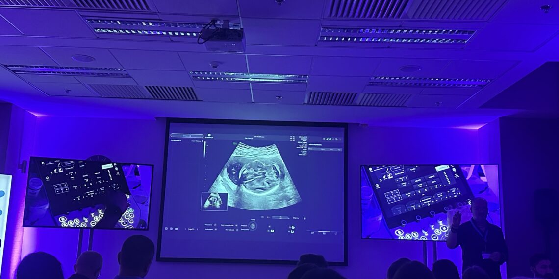 Specialiștii în sonografie fetală, la cursul Voluson User Days