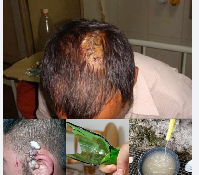 După primar și viceprimarul de Dobrești a primit o palmă din partea unui localnic cu probleme penale