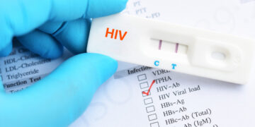 Un tânăr de 24 de ani, cuceritor de profesie, condamnat pentru transmiterea HIV-SIDA, în forma tentativei