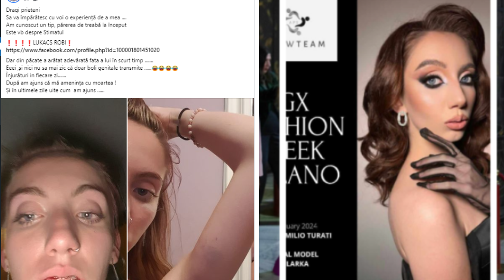 Model orădean de top, fostă miss, bătută și desfigurată de un individ cu care avea o relație. Spune că e amenințată cu moartea