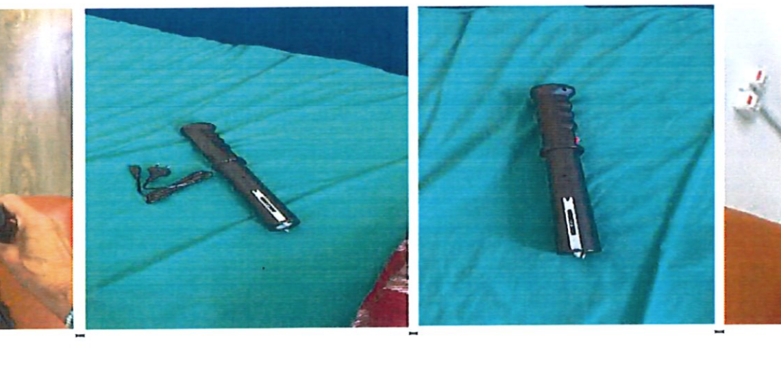 Rezultatul anchetei la Spitalul din Psihiatrie din Stei după ce pacienții au susținut ca au fost bătuţi, electrocutaţi, chiar violaţi şi legaţi de paturi.”Echipa de monitorizare consideră că obiectul constituie un instrument de tortură psihică şi fizică, prin care pacienții sunt constrânși să facă diferite lucruri”