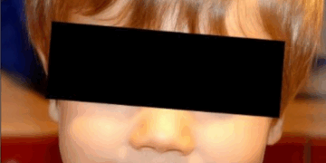 Cazul dramatic de malpraxis al copilașului decedat judecat cu celeritate în apel